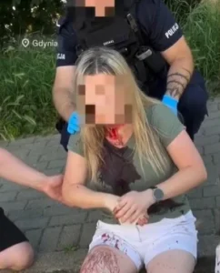 У Гдині невідомий двічі вдарив українку палицею